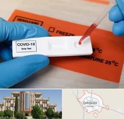 آزمایشگاه کرونا در دهدشت