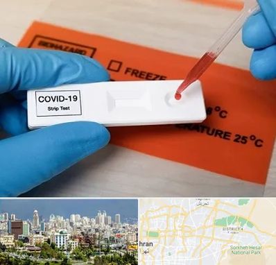آزمایشگاه کرونا در شرق تهران 