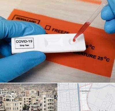 آزمایشگاه کرونا در اسکندری