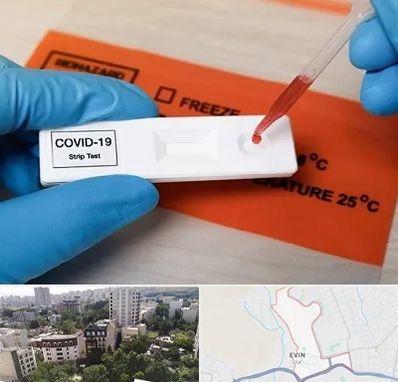 آزمایشگاه کرونا در اوین