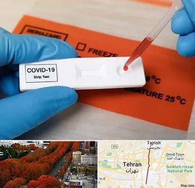آزمایشگاه کرونا در ولیعصر 