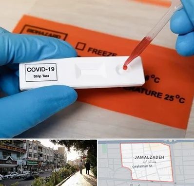 آزمایشگاه کرونا در خیابان جمالزاده