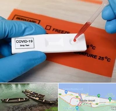 آزمایشگاه کرونا در بندر انزلی