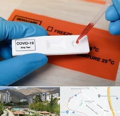 آزمایشگاه کرونا در شهر زیبا 