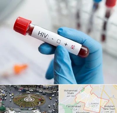 آزمایشگاه ایدز در فردیس کرج 