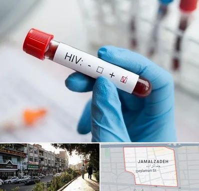 آزمایشگاه ایدز در خیابان جمالزاده