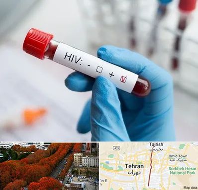 آزمایشگاه ایدز در ولیعصر 