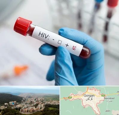 آزمایشگاه ایدز در گرگان