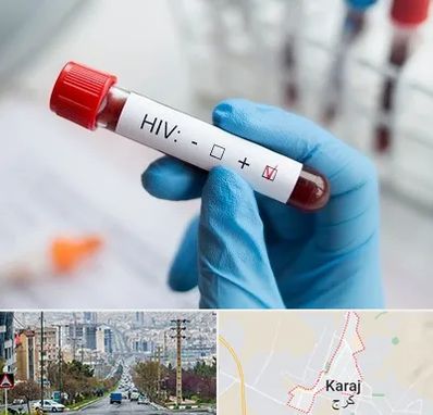 آزمایشگاه ایدز در گوهردشت کرج 