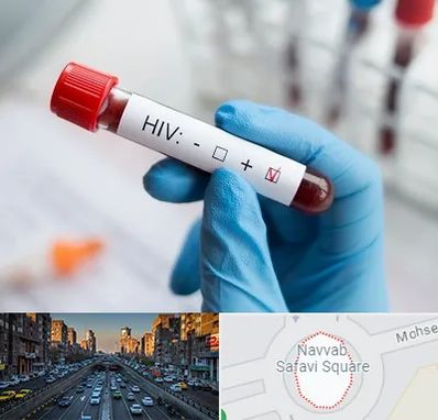 آزمایشگاه ایدز در نواب