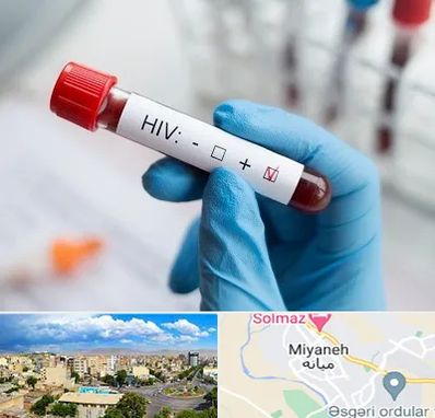 آزمایشگاه ایدز در میانه