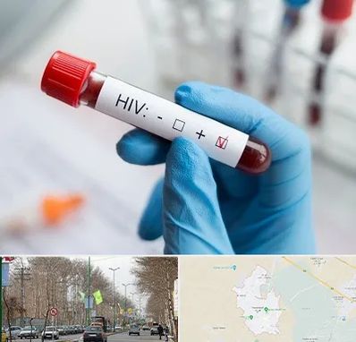 آزمایشگاه ایدز در نظرآباد کرج