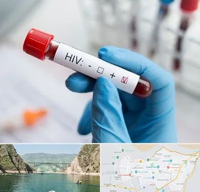 آزمایشگاه ایدز در ایلام