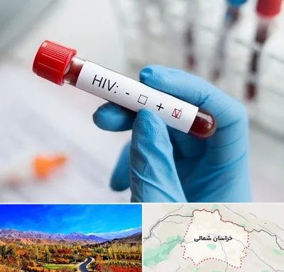 آزمایشگاه ایدز در خراسان شمالی
