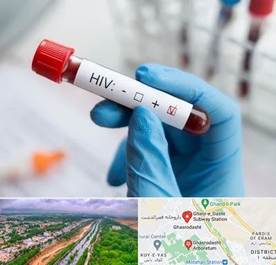 آزمایشگاه ایدز در قصرالدشت شیراز