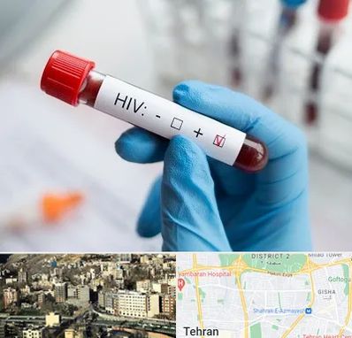 آزمایشگاه ایدز در مرزداران 