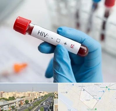 آزمایشگاه ایدز در کیانمهر کرج