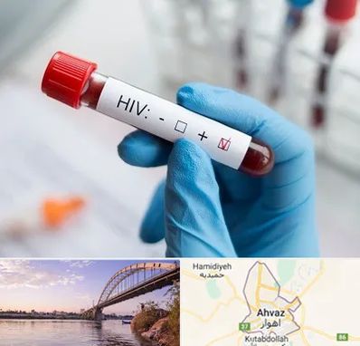 آزمایشگاه ایدز در اهواز