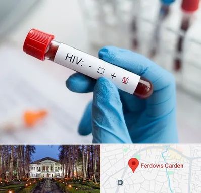 آزمایشگاه ایدز در باغ فردوس