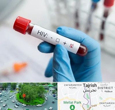 آزمایشگاه ایدز در تجریش 