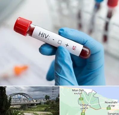 آزمایشگاه ایدز در چالوس