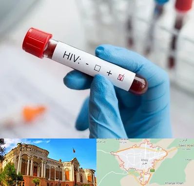 آزمایشگاه ایدز در خوی