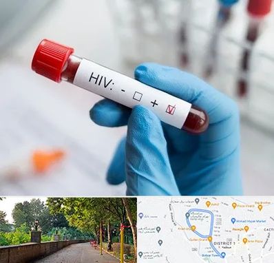 آزمایشگاه ایدز در بلوار گیلان رشت