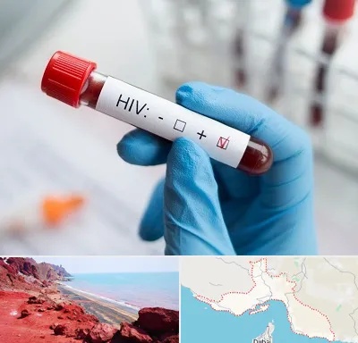 آزمایشگاه ایدز در هرمزگان