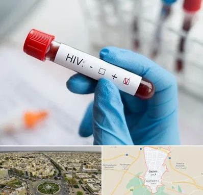 آزمایشگاه ایدز در قزوین