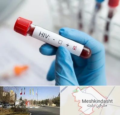 آزمایشگاه ایدز در مشکین دشت