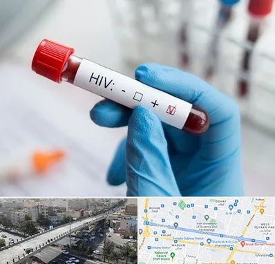 آزمایشگاه ایدز در فرجام