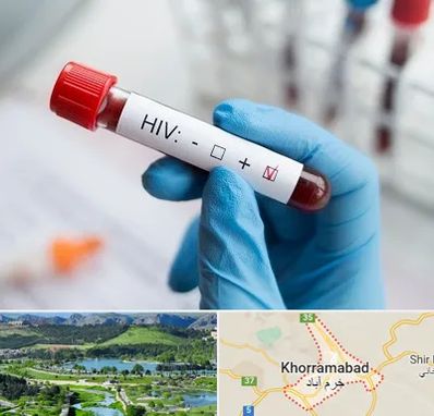آزمایشگاه ایدز در خرم آباد