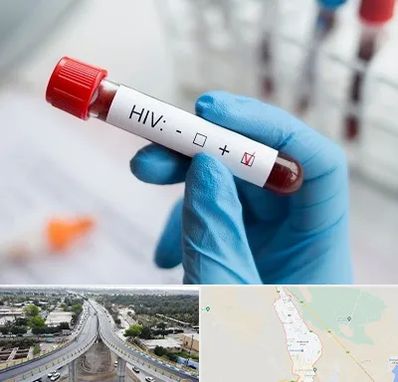 آزمایشگاه ایدز در اندیمشک