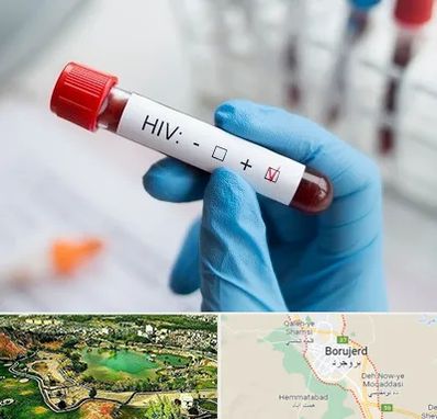 آزمایشگاه ایدز در بروجرد