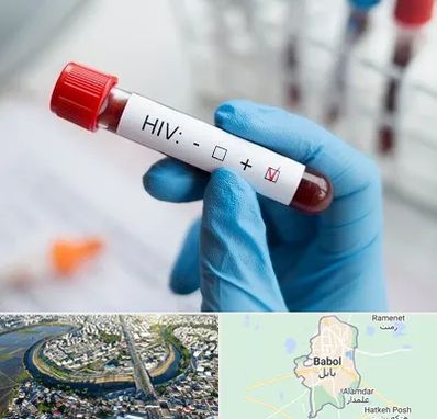 آزمایشگاه ایدز در بابل