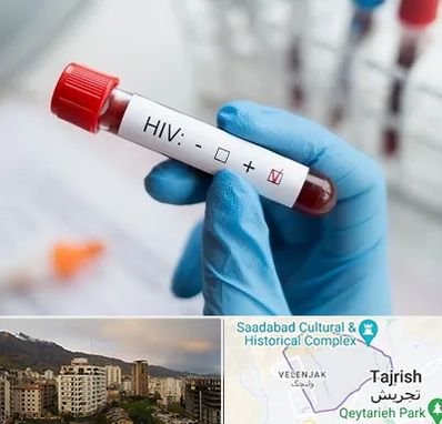 آزمایشگاه ایدز در زعفرانیه 