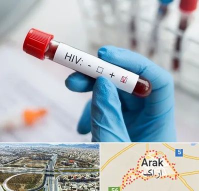 آزمایشگاه ایدز در اراک