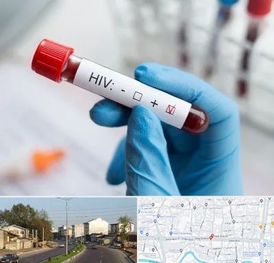 آزمایشگاه ایدز در ضیابری رشت