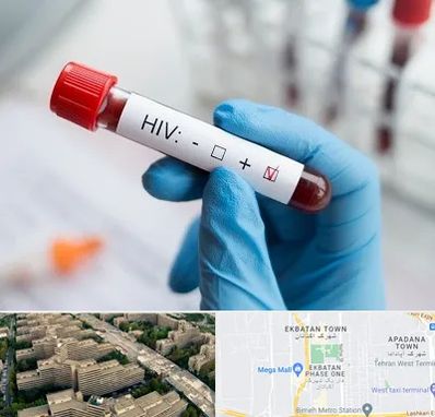 آزمایشگاه ایدز در اکباتان 