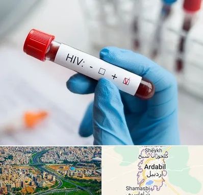 آزمایشگاه ایدز در اردبیل