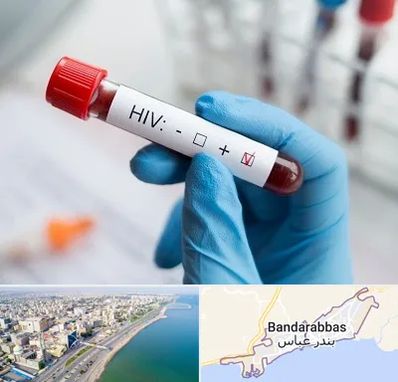 آزمایشگاه ایدز در بندرعباس