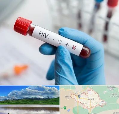 آزمایشگاه ایدز در مرند