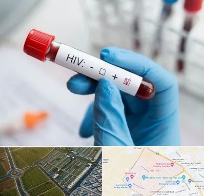 آزمایشگاه ایدز در الهیه مشهد