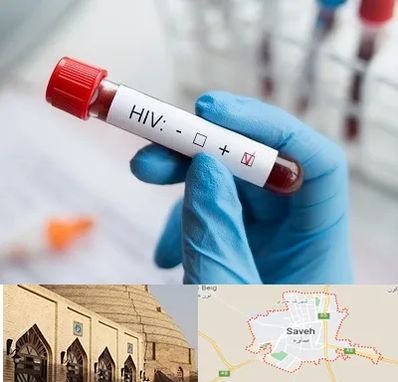 آزمایشگاه ایدز در ساوه