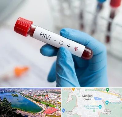 آزمایشگاه ایدز در لاهیجان