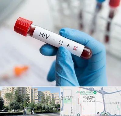 آزمایشگاه ایدز در آپادانا