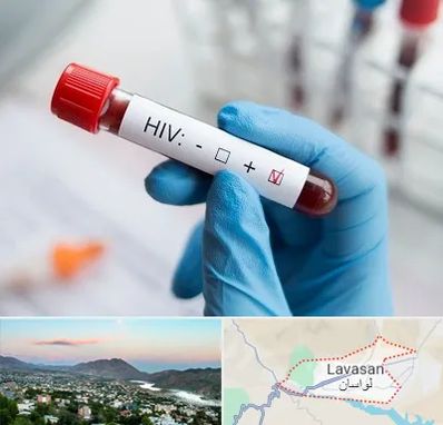 آزمایشگاه ایدز در لواسان