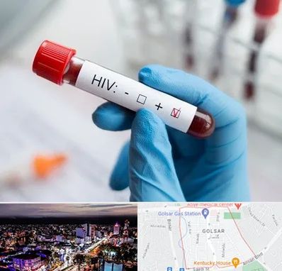 آزمایشگاه ایدز در گلسار رشت 