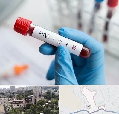آزمایشگاه ایدز در اوین