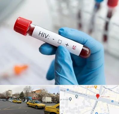 آزمایشگاه ایدز در شهناز تبریز